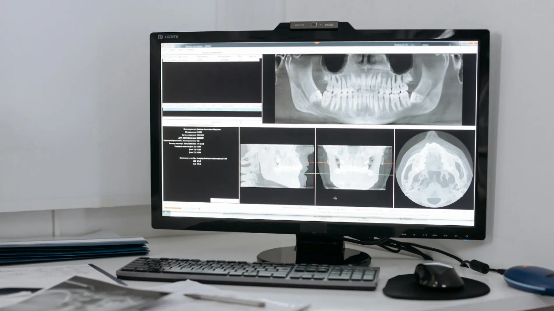 material de radiografías – CUE 2